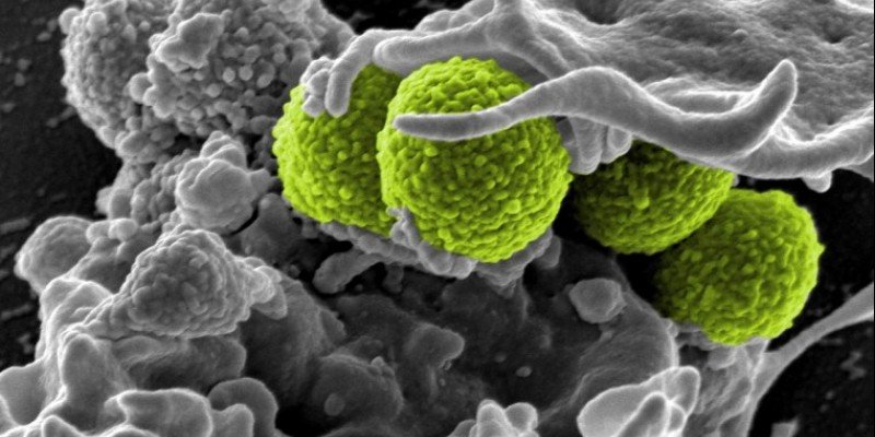 SOS για τη μικροβιακή αντίσταση στα αντιβιοτικά