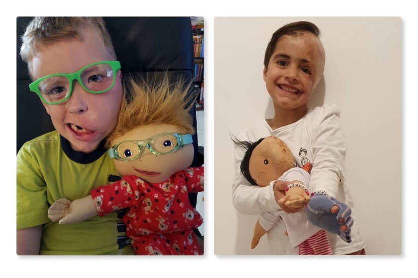 Φίλη μας έφτιαξε κούκλες που μοιάζουν σε παιδιά με αναπηρία κι όλο το ίντερνετ χειροκροτά